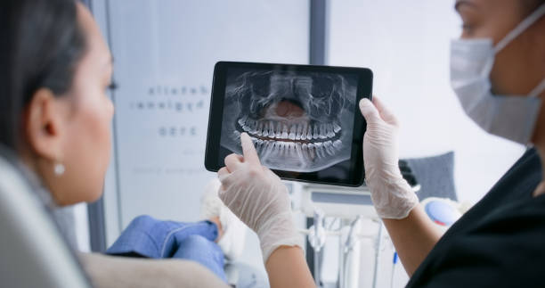 Licensed Teeth Whitening service in Woodstock, GA - Smile Center Dentistry
